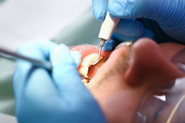 Best Walk-In Emergency Dentist in Thonotosassa, FL