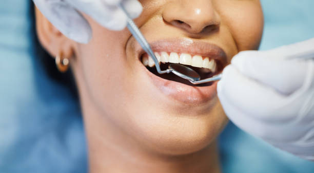 Best Emergency Wisdom Teeth Removal in Thonotosassa, FL