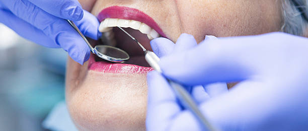 Best Emergency Root Canal Treatment in Thonotosassa, FL